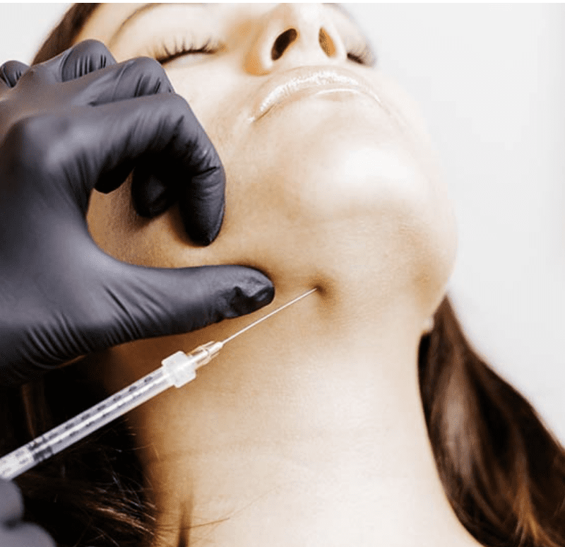 LIQUID LIPO” WITH KYBELLA