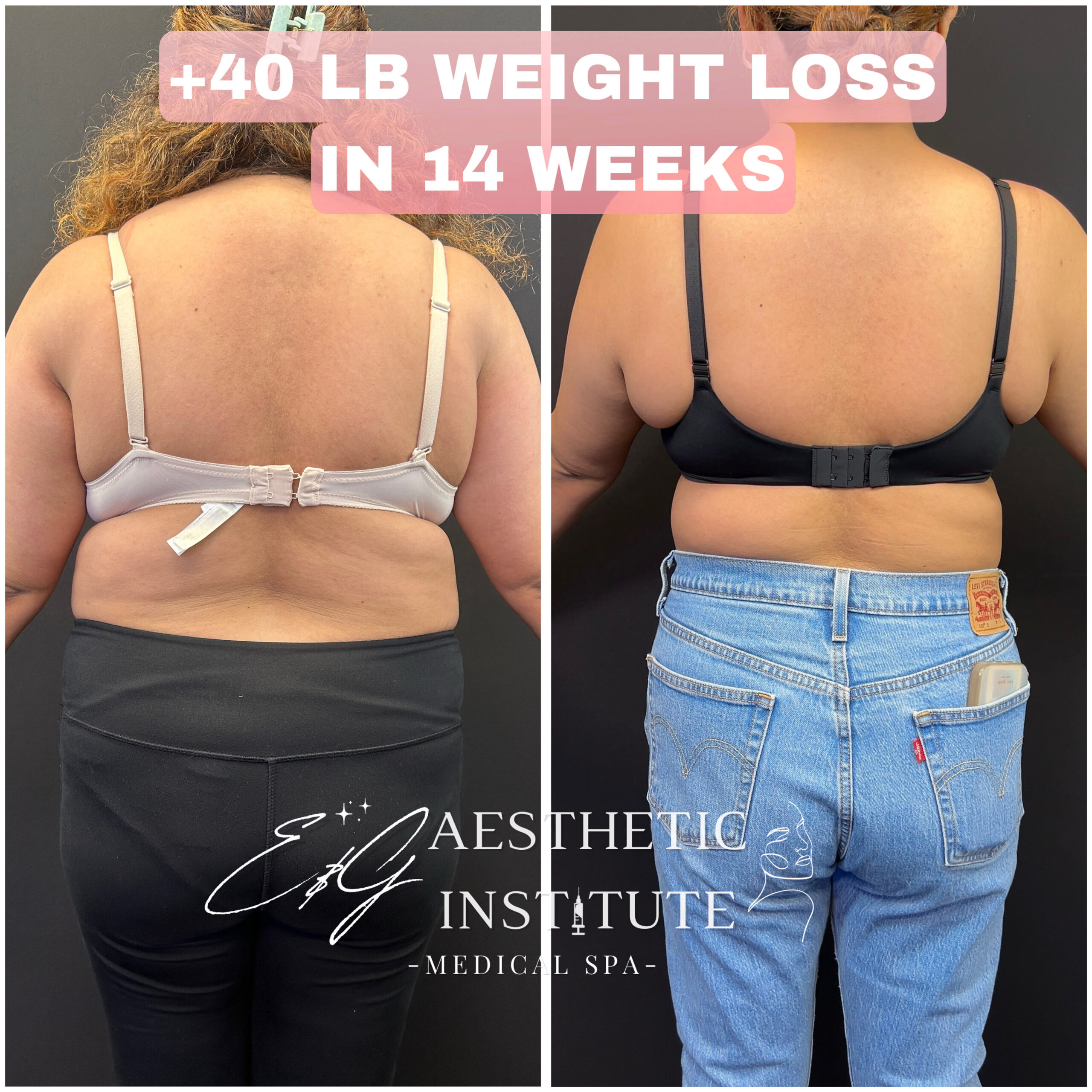 glp 1 newport beach Medical Weight Loss Newport Beach E&G Aesthetic Institute