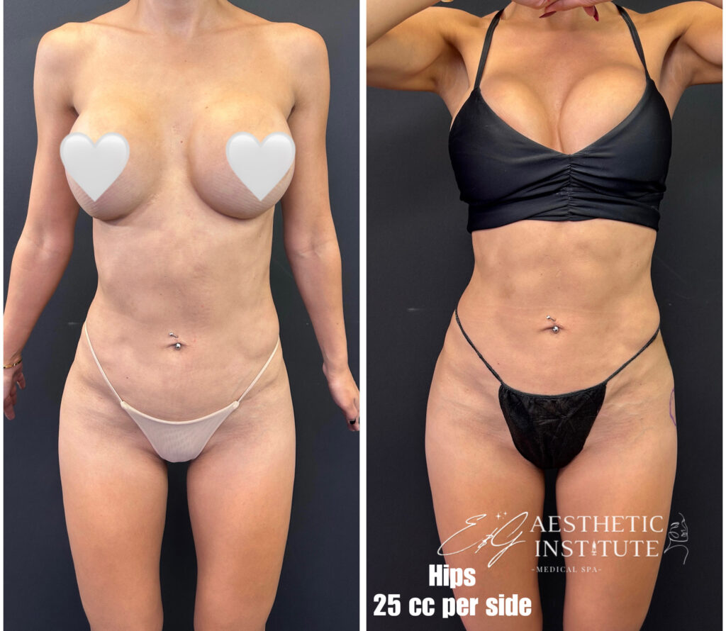 E&G Aesthetic Institute AlloClae Before and After E&G Aesthetic Institute AlloClae Before and After